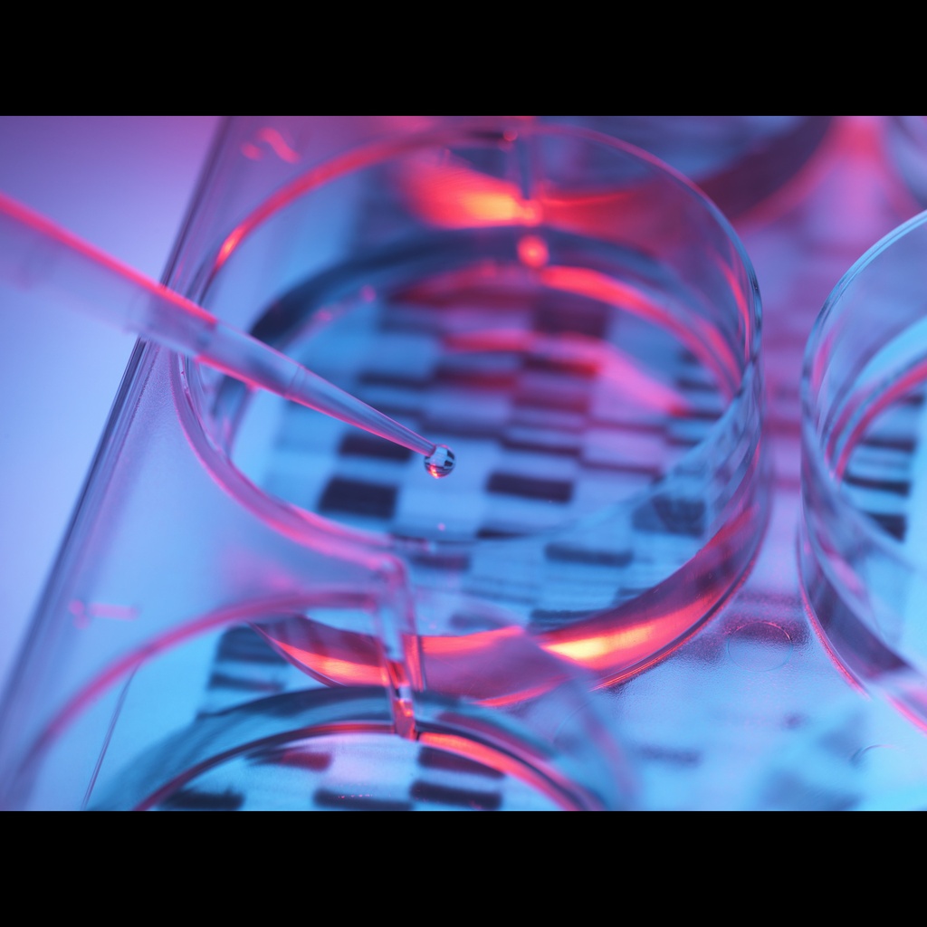 [0556-MBC002-R] Amplirun Aspergillus Fumigatus DNA Control size: 10,000size:20,000 c/µL