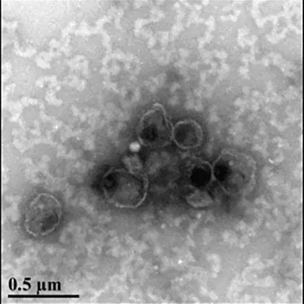 ExoQuick Ultra TC (20 rxns)